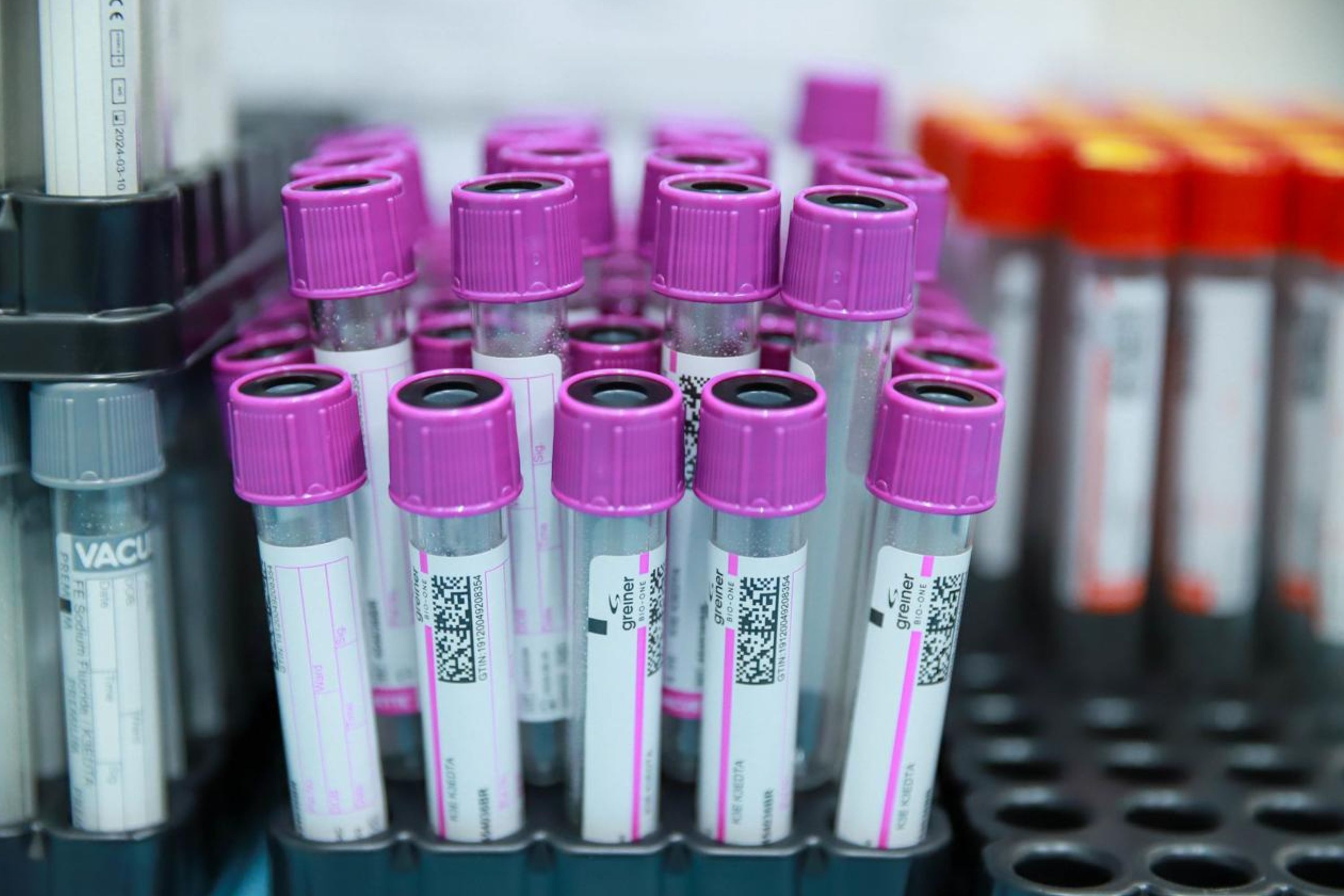 Projeto que prevê toxicológico para servidores municipais avança na Câmara de BH