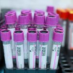 Projeto que prevê toxicológico para servidores municipais avança na Câmara de BH