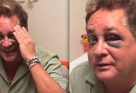 Leonardo dá entrada em hospital após acidente em barco