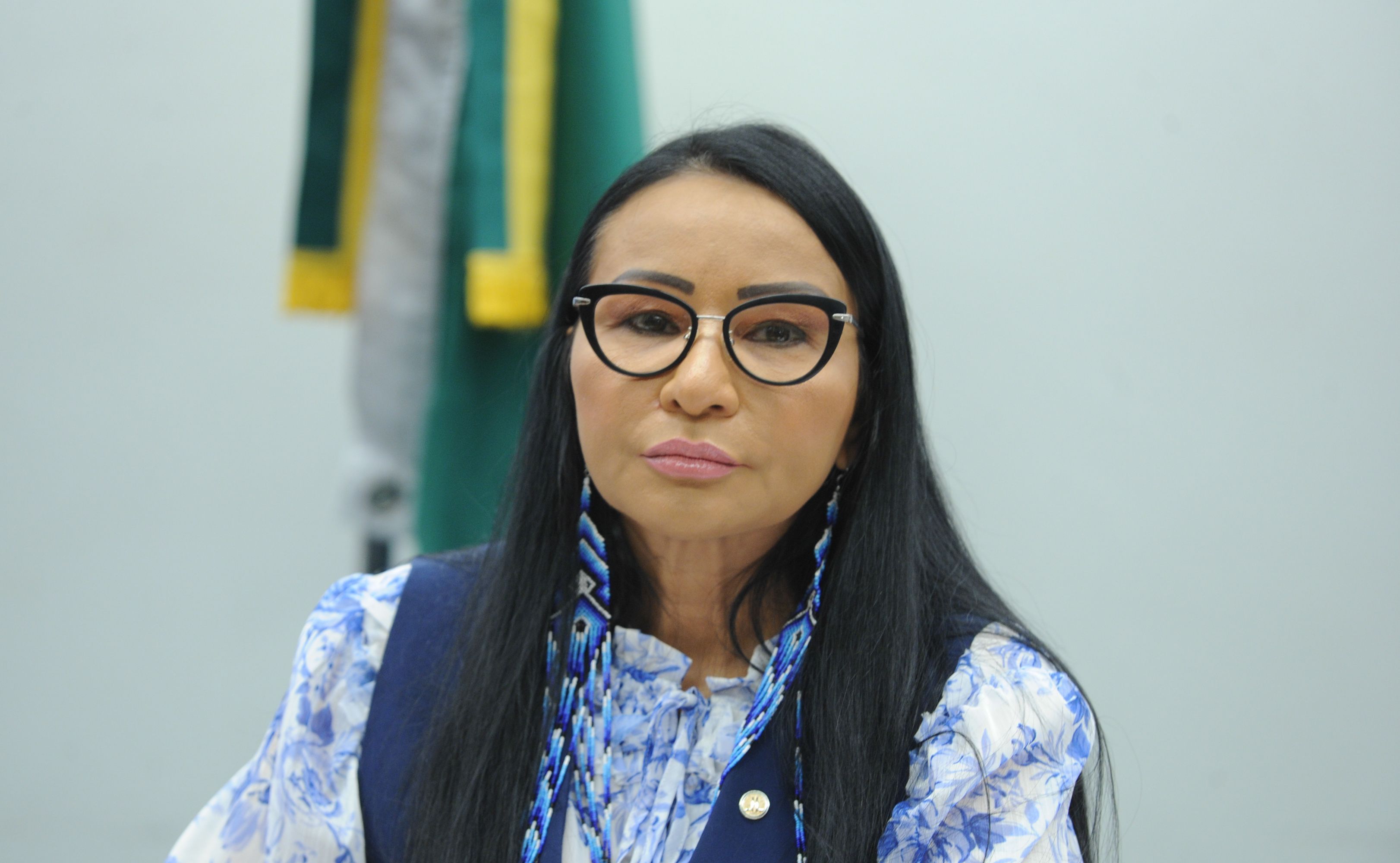TSE cassa deputada do PL por uso de recursos públicos em harmonização facial