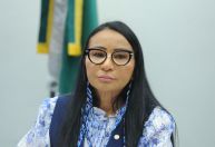 TSE cassa deputada do PL por uso de recursos públicos em harmonização facial