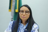 TSE cassa deputada do PL-AP por usar recursos públicos em harmonização facial