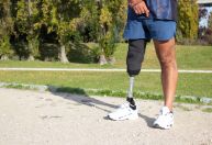 Abril Laranja: médica explica principais causas de amputação e como prevenir