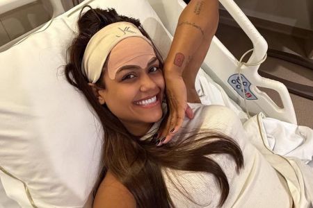 Camila Loures retira veia da testa por meio de procedimento estético