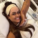 Endolaser: entenda procedimento para retirar veia feito por Camila Loures