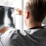 Anvisa aprova novo remédio para tratamento de câncer de pulmão