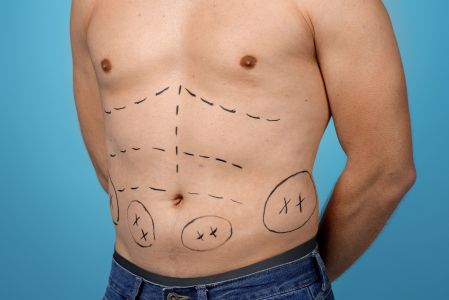 Homem paciente de cirurgia plástica