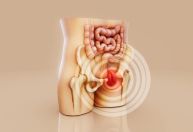 Hemorroidas: mudanças simples na dieta e tratamentos modernos evitam cirurgia