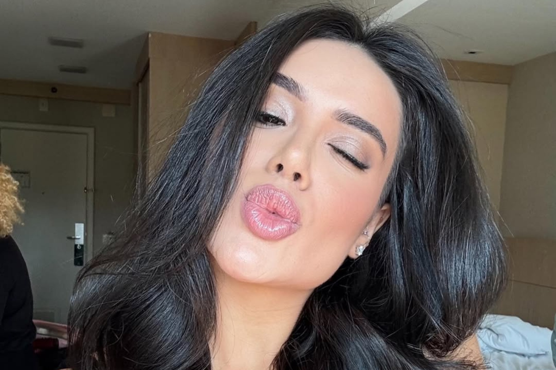 Boca de Jordana, do BBB 26, é falsa? Médica explica procedimento