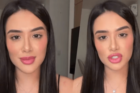 Jordana comenta sobre procedimento na boca • Reprodução | Redes Sociais
