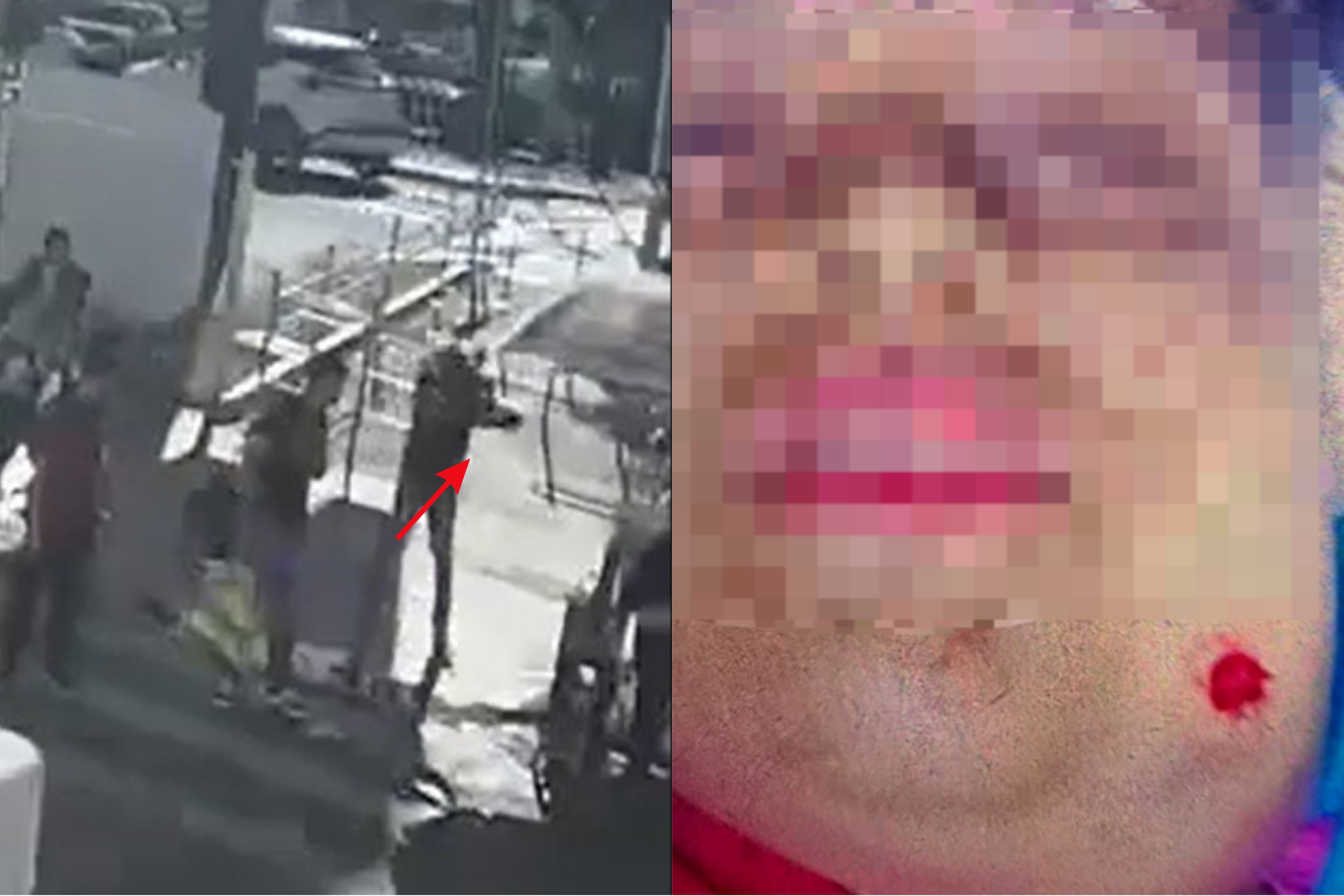 Jovem autista é baleada no rosto após sorrir para homem em Goiânia; veja vídeo