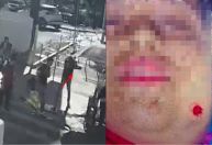 Jovem autista é baleada no rosto após sorrir para homem em Goiânia; veja vídeo