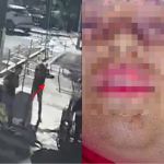 Jovem autista é baleada no rosto após sorrir para homem em Goiânia; veja vídeo