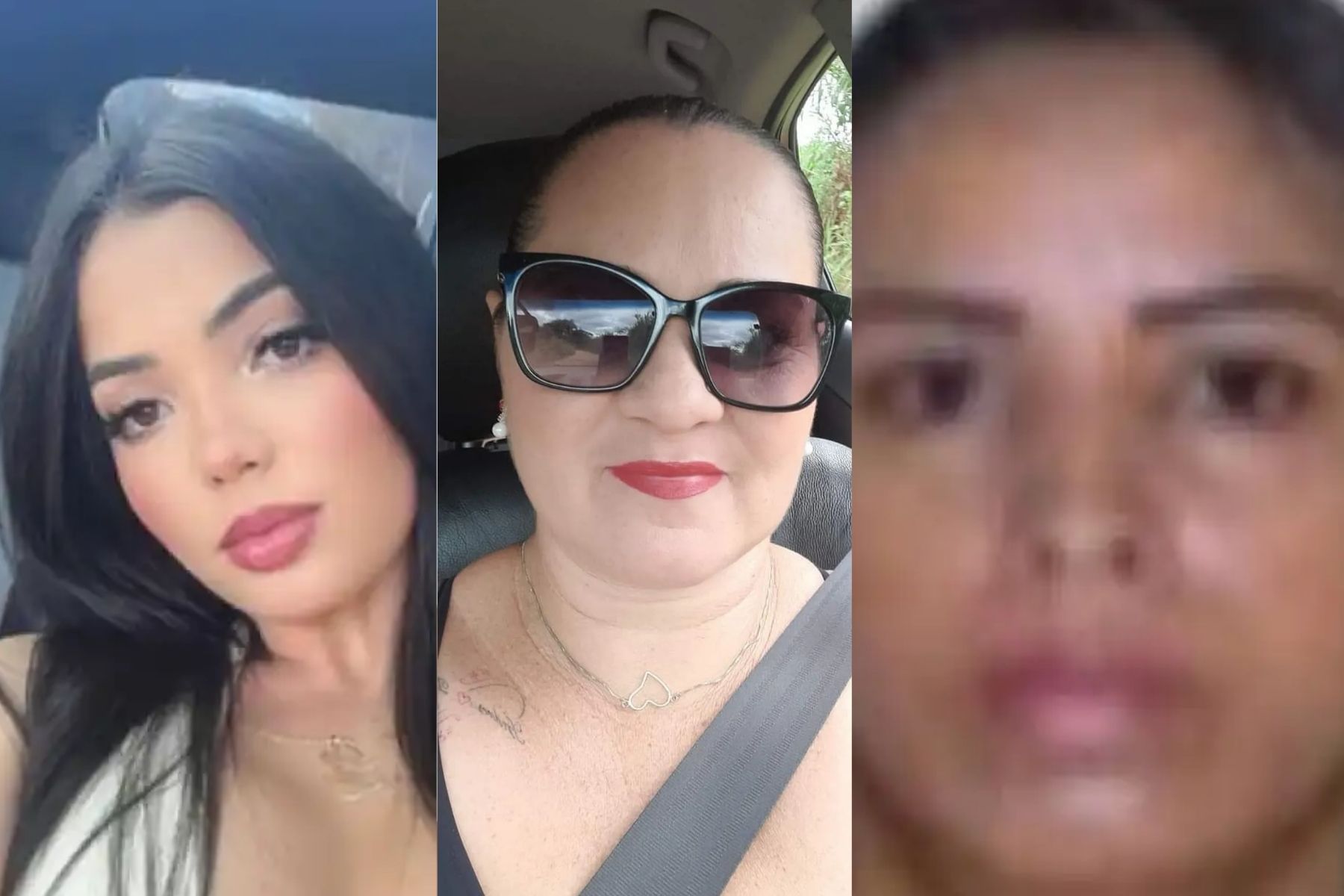 Jovem morre após cirurgia plástica em BH: local já teve outras mortes durante procedimentos