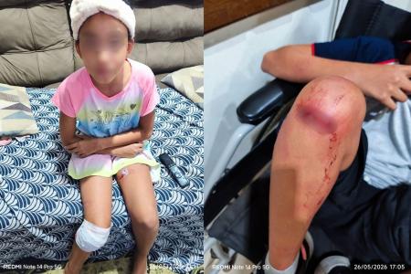 Uma criança de 10 anos foi atacada por um cachorro da raça Pastor Alemão • Imagens cedidas