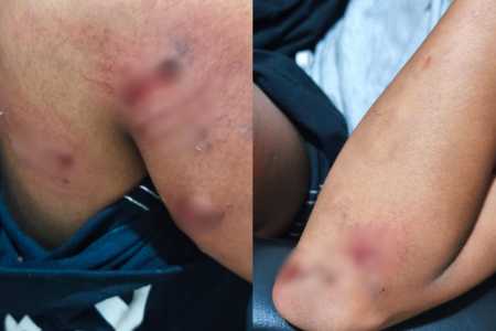 cão pulou o muro e tacou Isabelle • Imagens cedias