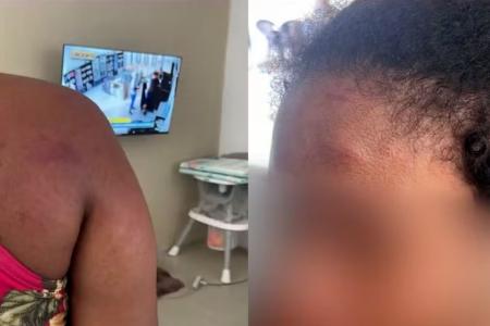 Polícia investiga agressão contra doméstica acusada de roubo por ex-patroa • Reprodução/ TV Mirante
