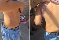 Padrasto é preso suspeito de espancar enteado que teve fratura facial em BH