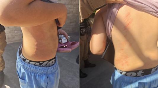 Padrasto é preso suspeito de espancar enteado que teve fratura facial em BH