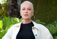 Xuxa relata luta contra alopecia e exibe resultado de transplante capilar