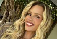 Yasmin Brunet diz que 'morador de rua' a diagnosticou com doença pouco falada