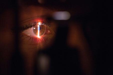 Glaucoma