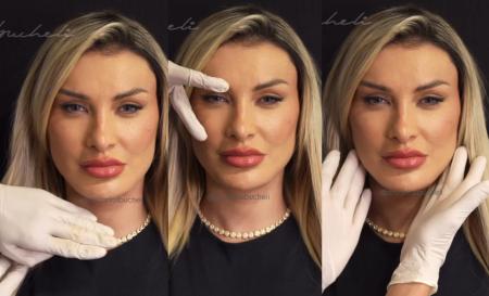 Andressa Urach mostra novo rosto • Reprodução | Redes sociais