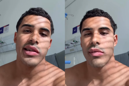 Nilo precisou fazer pausa na carreira após descobrir paralisia facial