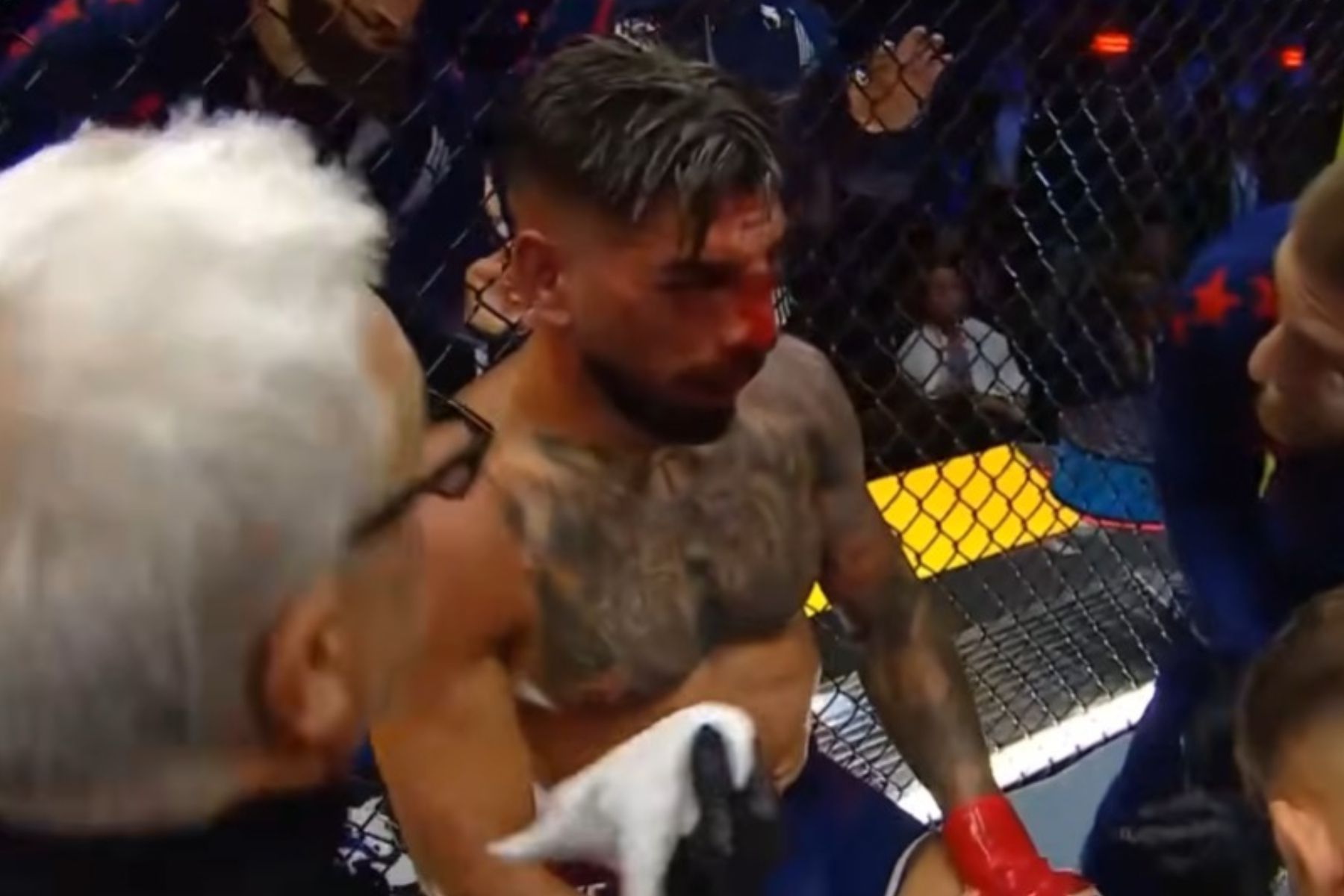 Topuria tem fraturas na face e recebe suspensão de seis meses após derrota no UFC