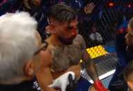 Topuria tem fraturas na face e recebe suspensão de seis meses após derrota no UFC