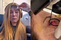 Mari Maria revela tratamento para tumores abaixo dos olhos: 'Dolorido'