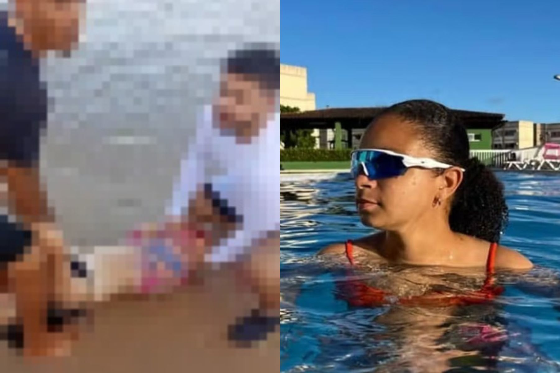 Mulher mordida por tubarão em Recife foi resgatada já sem a perna, diz primo