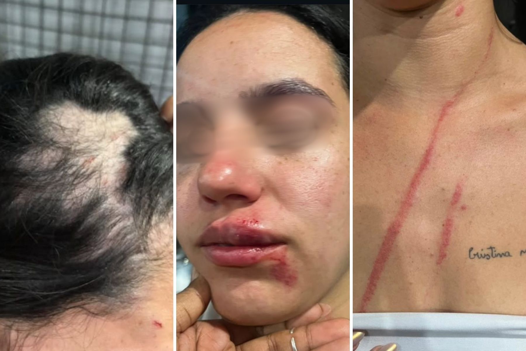 Jovem denuncia agressão de servidoras da prefeitura de Belford Roxo em karaokê