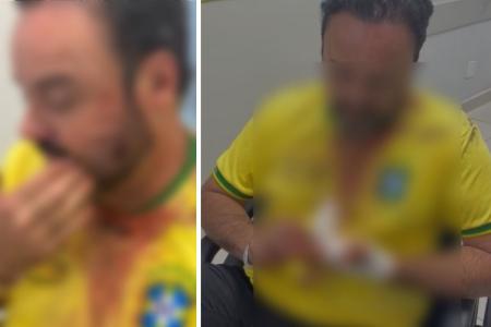 Vereador é suspeito de agredir homem com garrafada em boate em Divinópolis-MG
