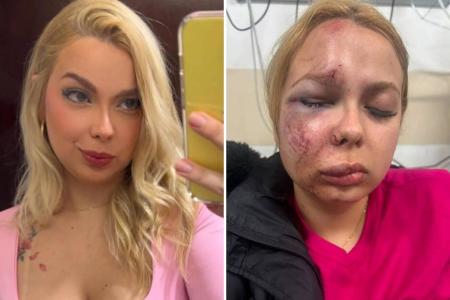 Fotos mostram como a vítima ficou após as agressões • Reprodução Redes Sociais e Arquivo Pessoal
