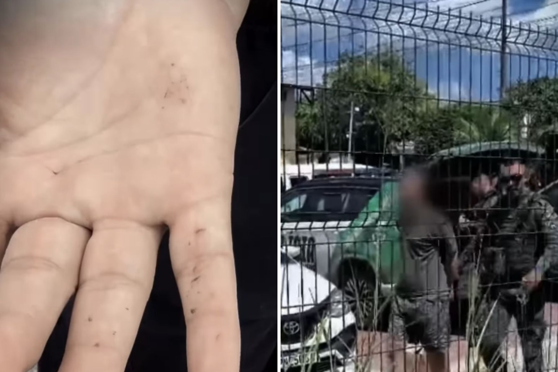 Técnica de enfermagem do Samu é agredida durante atendimento em Fortaleza