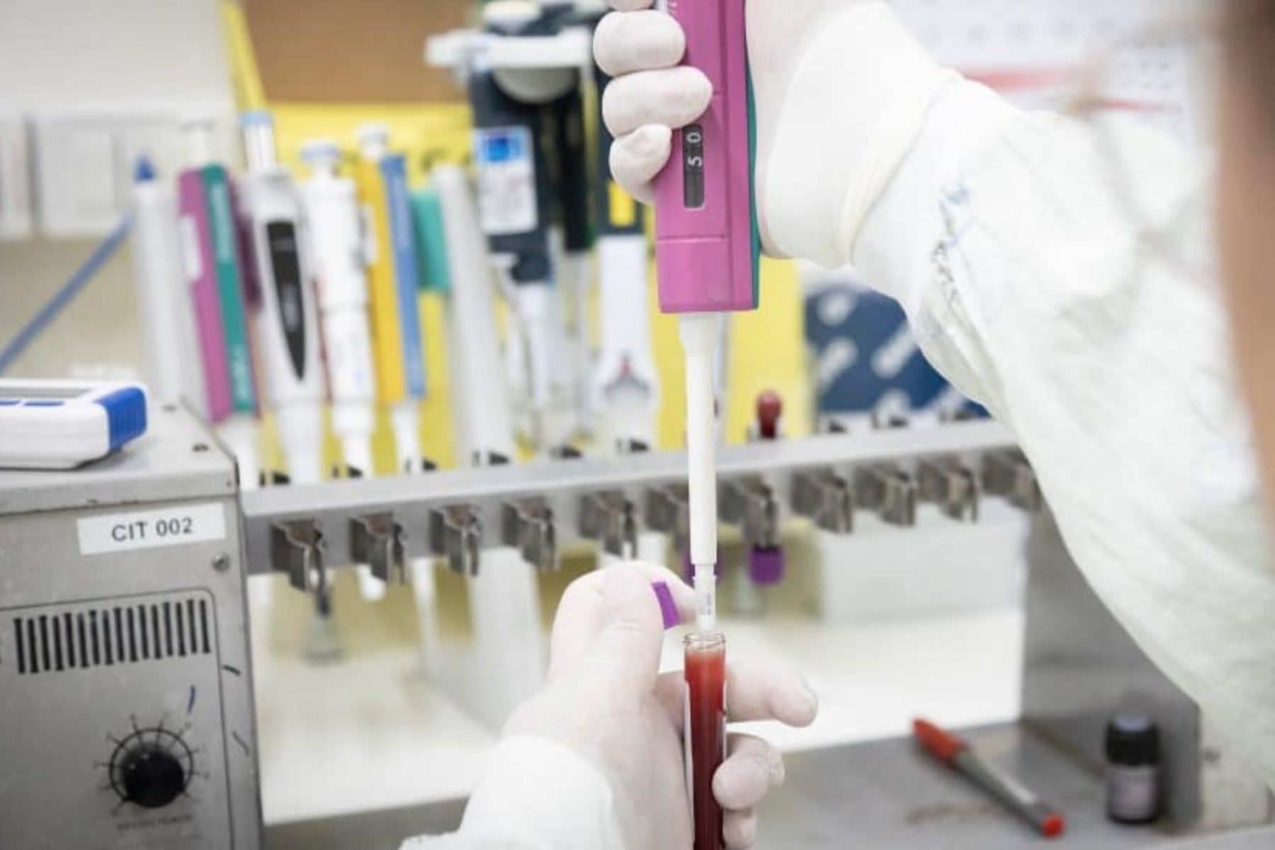 São Paulo descarta segundo caso suspeito de ebola em 2026