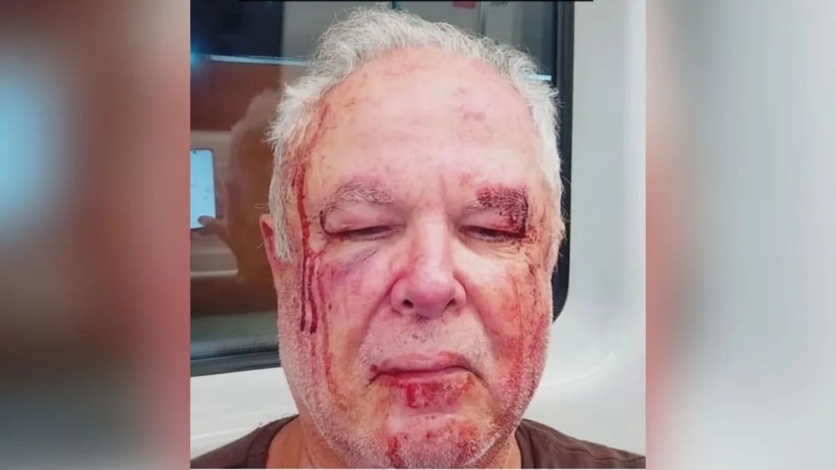 Agressão a militante petista é investigada pela PC do Rio de Janeiro