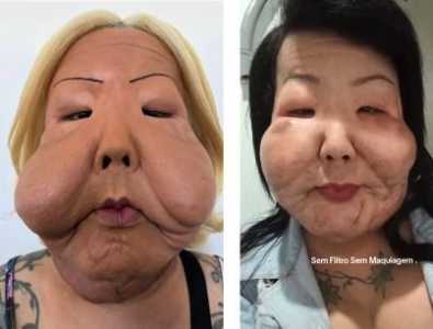 Juju do Pix seis meses após início da reconstrução facial • Reprodução/Instagram