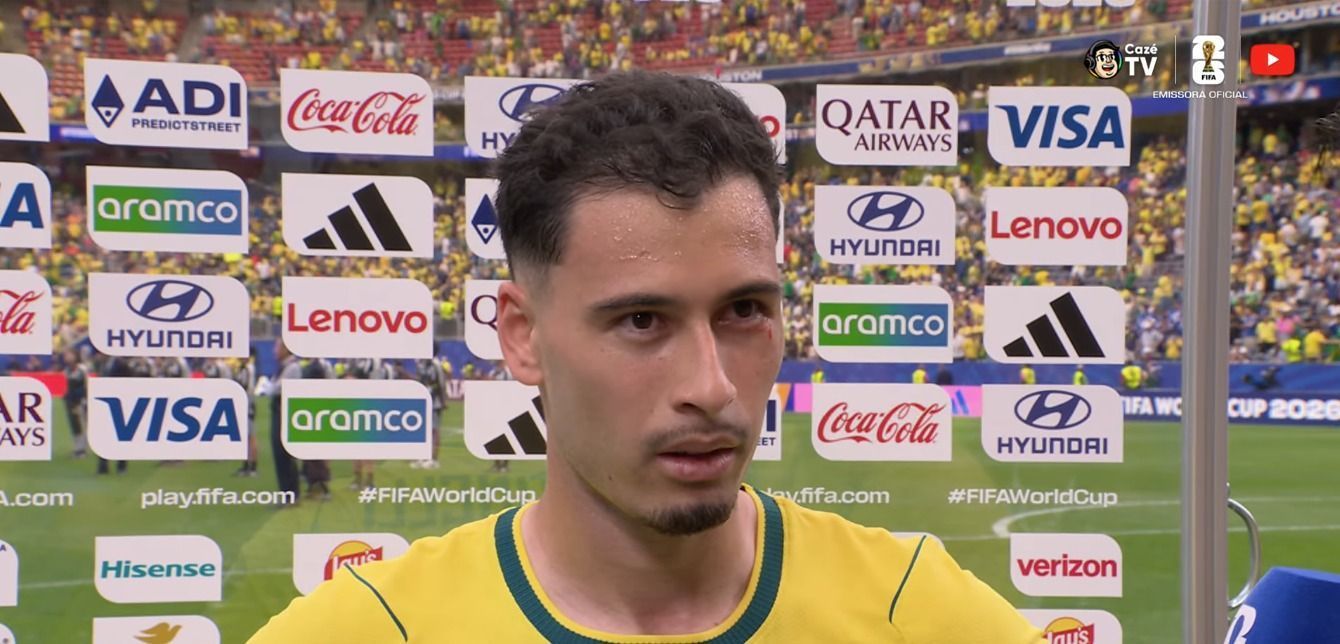 Brasil x Japão: Martinelli deixa gramado machucado após cotovelada