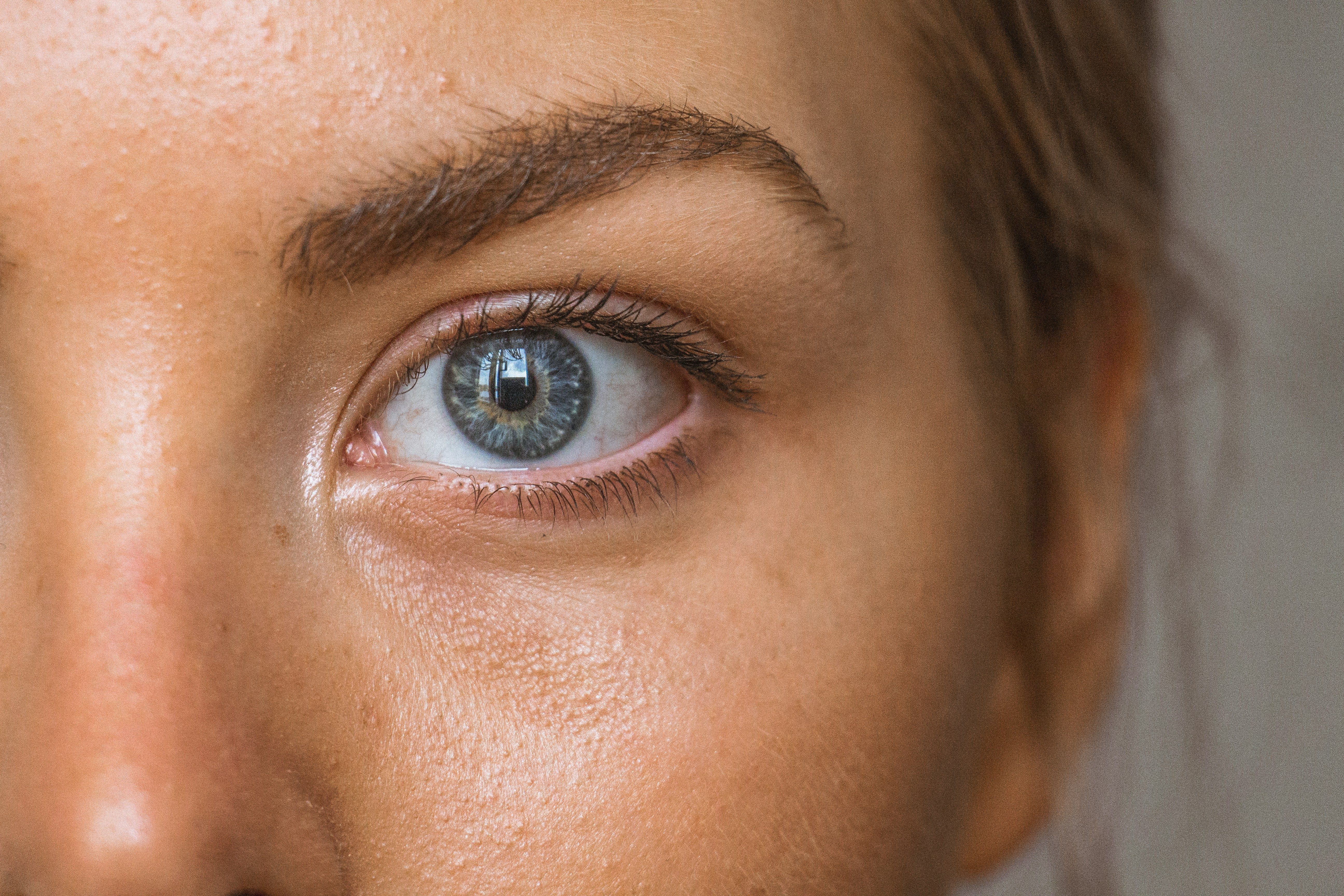 Blefaroplastia: especialista explica qual a idade ideal para a cirurgia