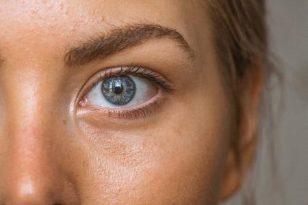 Blefaroplastia