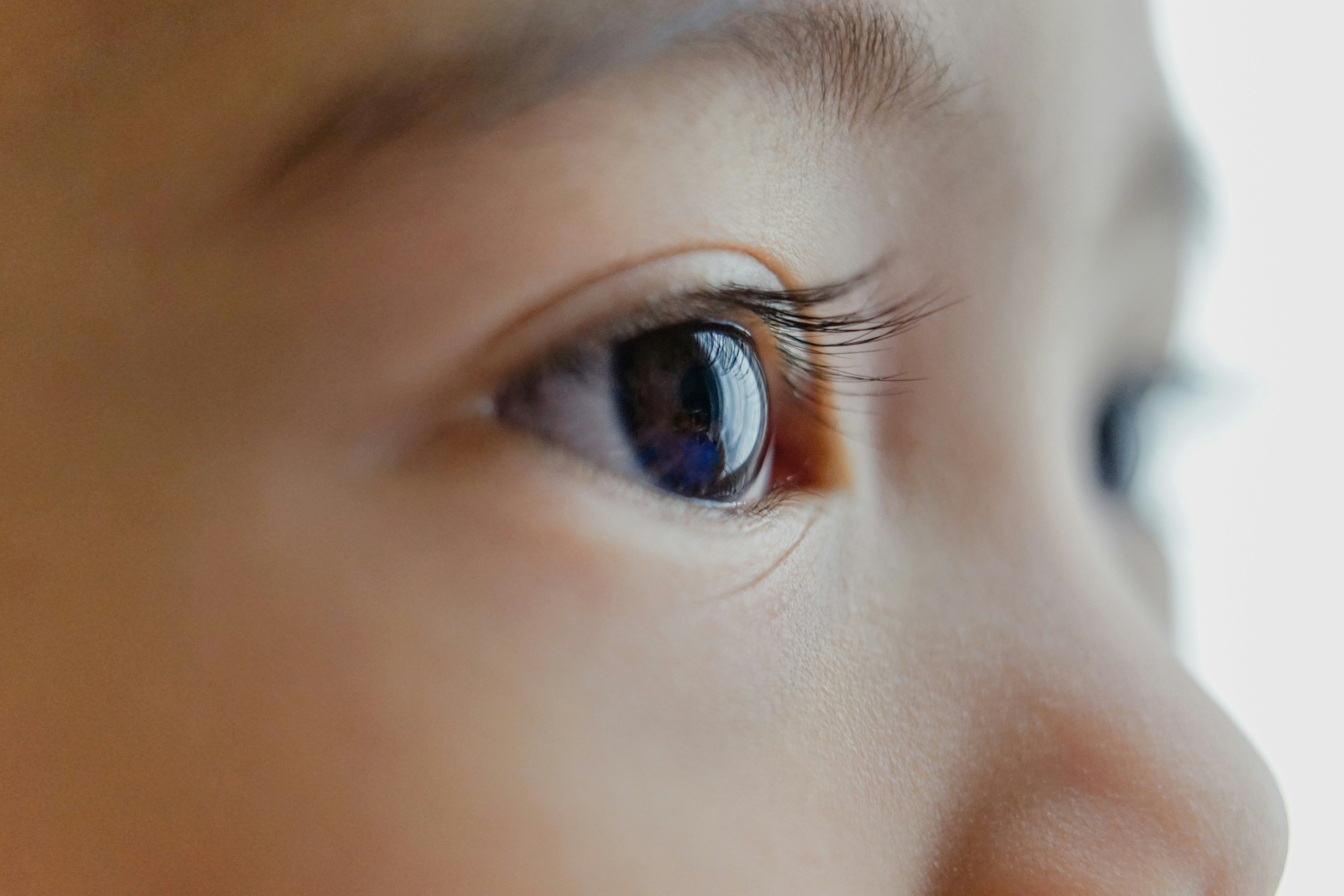 Crianças podem ter glaucoma? Oftalmologista explica