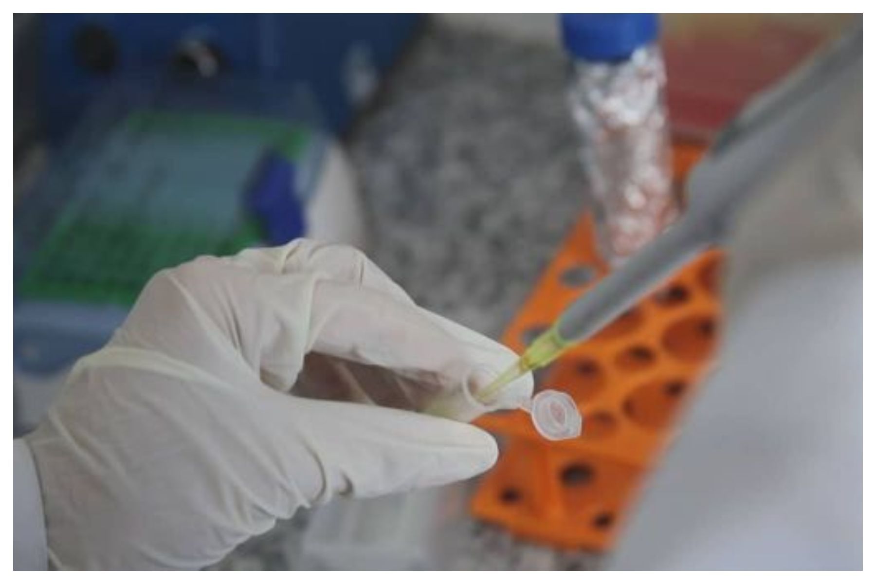 Pesquisadores identificam estratégia contra leucemia resistente à quimioterapia