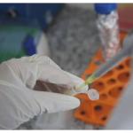 Pesquisadores identificam estratégia contra leucemia resistente à quimioterapia