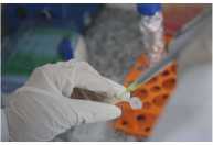 Pesquisadores identificam estratégia contra leucemia resistente à quimioterapia