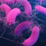 Pseudomonas aeruginosa: conheça bactéria detectada em lotes da Crystal e da Ypê
