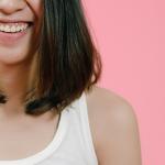 Sorriso gengival: quando a condição é apenas estética e quando exige tratamento