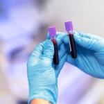Novas diretrizes mudam alerta para falta de ferro antes da anemia nos EUA