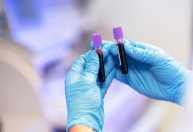 Cientistas criam, pela primeira vez, células semelhantes às do sangue de cães em laboratório